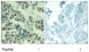 Anti-MDM2 Rabbit Polyclonal Antibody