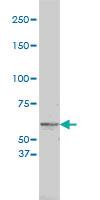 Anti-TYR Mouse Monoclonal Antibody [clone: 2A2-F4]