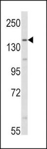 Anti-AOX1 Rabbit Polyclonal Antibody (Biotin)