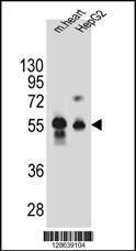 Anti-DPEP3 Rabbit Polyclonal Antibody (Biotin)