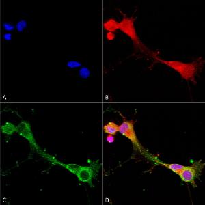 Immunocytochemistry/Immunofluorescence analysis of human neuroblastoma cells (SH-SY5Y), fixed in 4% PFA for 15 min, using Anti-ASIC1 Antibody [S271-44] (A305010), at 1:100 for overnight at 4°C with slow rockin