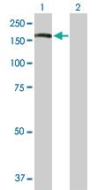 Anti-ADAR Rabbit Polyclonal Antibody