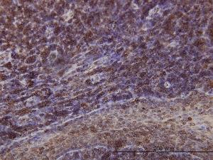 Anti-EMD Mouse Monoclonal Antibody [clone: 3B9]