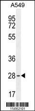 Anti-BTF3 Rabbit Polyclonal Antibody (HRP (Horseradish Peroxidase))