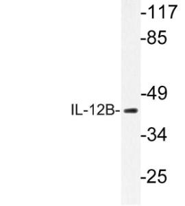 Western blot analysis of lysate from K562 cells using Anti-IL-12B Antibody