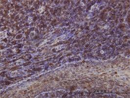 Anti-EMD Mouse Monoclonal Antibody [clone: 3B9]