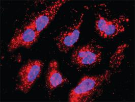 Anti-CDK6 + CTNNB1 Antibody Pair