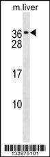 Anti-CACNG1 Rabbit Polyclonal Antibody (AP (Alkaline Phosphatase))