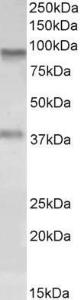 Anti-AOC3 Antibody (A84782) (0.1 µg/ml) staining of A549 lysate (35 µg protein in RIPA buffer). Primary incubation was 1 hour. Detected by chemilu minescence