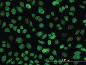 Anti-EMD Mouse Monoclonal Antibody [clone: 3B9]