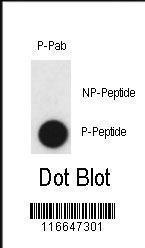 Anti-CLDN2 Rabbit Polyclonal Antibody (PE (Phycoerythrin))