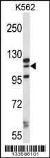 Anti-MORC1 Rabbit Polyclonal Antibody (HRP (Horseradish Peroxidase))