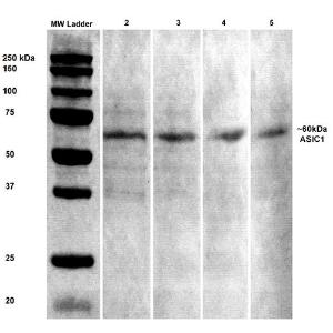 Western blot analysis of rat brain lysates showing detection of ASIC1 protein using Anti-ASIC1 Antibody [S271-44] (A305010) at 1:100, 1:250, 1:500, and 1:1,000