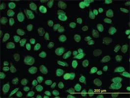 Anti-EMD Mouse Monoclonal Antibody [clone: 3B9]