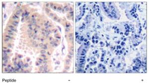 Anti-EIF4B Rabbit Polyclonal Antibody