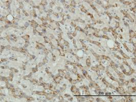 Anti-TYR Mouse Monoclonal Antibody [clone: 2A2-F4]