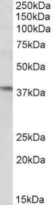 Anti-AIM2 antibody