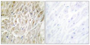 Immunohistochemical analysis of paraffin-embedded human heart tissue using Anti-DLX3 Antibody The right hand panel represents a negative control, where the antibody was pre-incubated with the immunising peptide