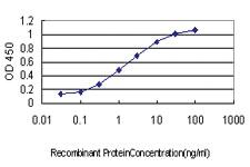 Anti-EMD Mouse Monoclonal Antibody [clone: 3B9]