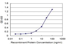 Anti-HOXC12 Mouse Monoclonal Antibody [clone: 3E1]