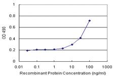 Anti-RAB31 Antibody Pair