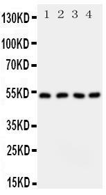 Anti-SPTLC1 Rabbit Polyclonal Antibody