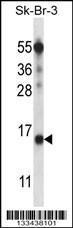 Anti-BTF3L4 Rabbit Polyclonal Antibody (Biotin)