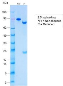 SDS-PAGE analysis of Anti-Keratin 77 Antibody [KRTL/1577R] under non-reduced and reduced conditions; showing intact IgG and intact heavy and light chains, respectively. SDS-PAGE analysis confirms the integrity and purity of the antibody.