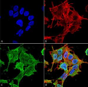 Immunocytochemistry/Immunofluorescence analysis of human neuroblastoma cell line (SK-N-BE, fixed in 4% formaldehyde for 15 min at room temperature, using Anti-ASIC1 Antibody [S271-44] (A305010), at 1:100 for 60 minutes at room temperatur