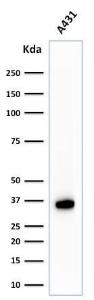 Western blot analysis of A431 cell lysate using Anti-Nucleophosmin Antibody [NPM1/1902]