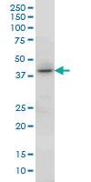 Anti-HOXC13 Mouse Monoclonal Antibody [clone: 10D4]