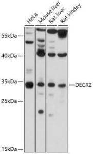 Western blot analysis of extracts of various cell lines, using Anti-DECR2/PDCR Antibody (A306131) at 1:1,000 dilution