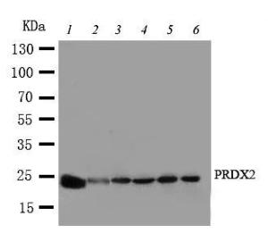 Anti-Peroxiredoxin 2 Rabbit Polyclonal Antibody