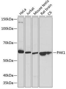 Western blot analysis of extracts of various cell lines, using Anti-PAK1 Antibody [ARC0087] (A307809) at 1:1,000 dilution