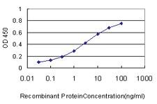 Anti-HOXC13 Mouse Monoclonal Antibody [clone: 10D4]