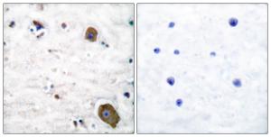 Immunohistochemical analysis of paraffin-embedded human brain tissue using Anti-GFR alpha-1 Antibody. The right hand panel represents a negative control, where the antibody was pre-incubated with the immunising peptide