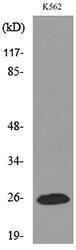 Western blot analysis of lysate from K562 cells using Anti-IGFBP6 Antibody