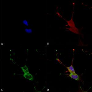 Immunocytochemistry/Immunofluorescence analysis of human neuroblastoma cells (SH-SY5Y), fixed in 4% PFA for 15  min, using Anti-LGI1 Antibody [S283-7] (A305011), at 1:100 for overnight at 4 °C with slow rocking