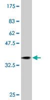 Anti-RAB31 Mouse Monoclonal Antibody [clone: 1C6]