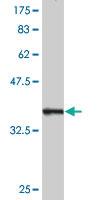 Anti-GOLM1 Mouse Monoclonal Antibody [clone: 3B10]