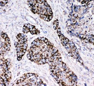 Anti-Peroxiredoxin 3 Rabbit Polyclonal Antibody