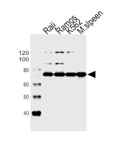 Anti-BTK Rabbit Polyclonal Antibody