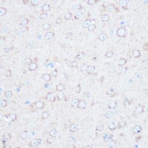 Antibody anti-TSC2 100 µl