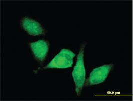 Anti-HDAC6 Mouse Polyclonal Antibody