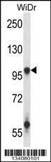 Anti-GRIA3 Rabbit Polyclonal Antibody (FITC (Fluorescein Isothiocyanate))