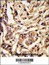 Anti-GALT Rabbit Polyclonal Antibody (PE (Phycoerythrin))