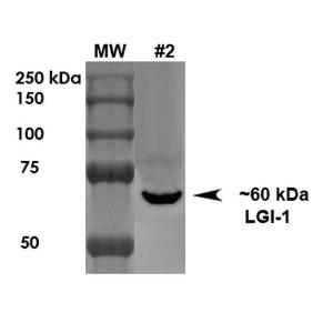 Western blot analysis of rat brain membrane showing detection of ~60 kDa LGI1 protein using Anti-LGI1 Antibody [S283-7] (A305011) at 1:1000 for 1 hour at room temperature. Load: 10 µg.