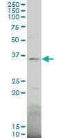 Anti-HOXD1 Mouse Polyclonal Antibody