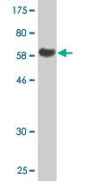 Anti-AHSG Mouse Monoclonal Antibody [clone: 1D8]