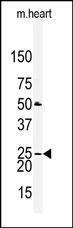 Anti-CLDN2 Rabbit Polyclonal Antibody (FITC (Fluorescein))